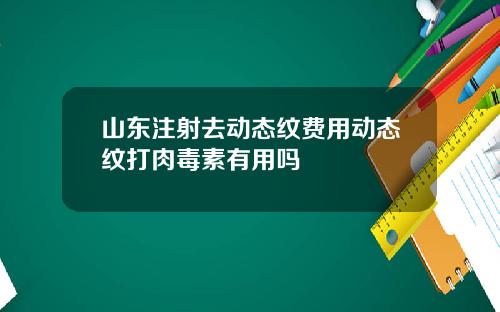 山东注射去动态纹费用动态纹打肉毒素有用吗